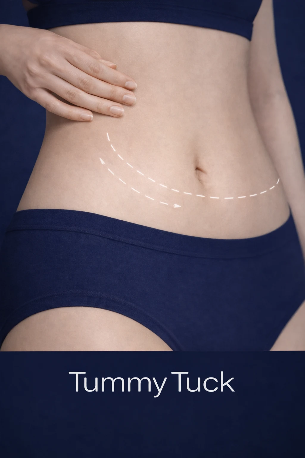 Tummy Tuck